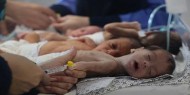 25 طفلا توفوا بسبب سوء التغذية في قطاع غزة